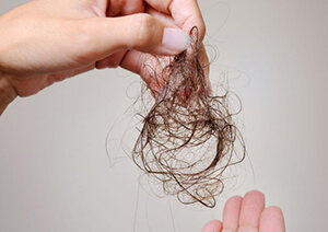 Biện pháp loại bỏ chứng rụng tóc