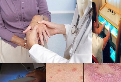 Mức độ nguy hiểm của bệnh viêm da